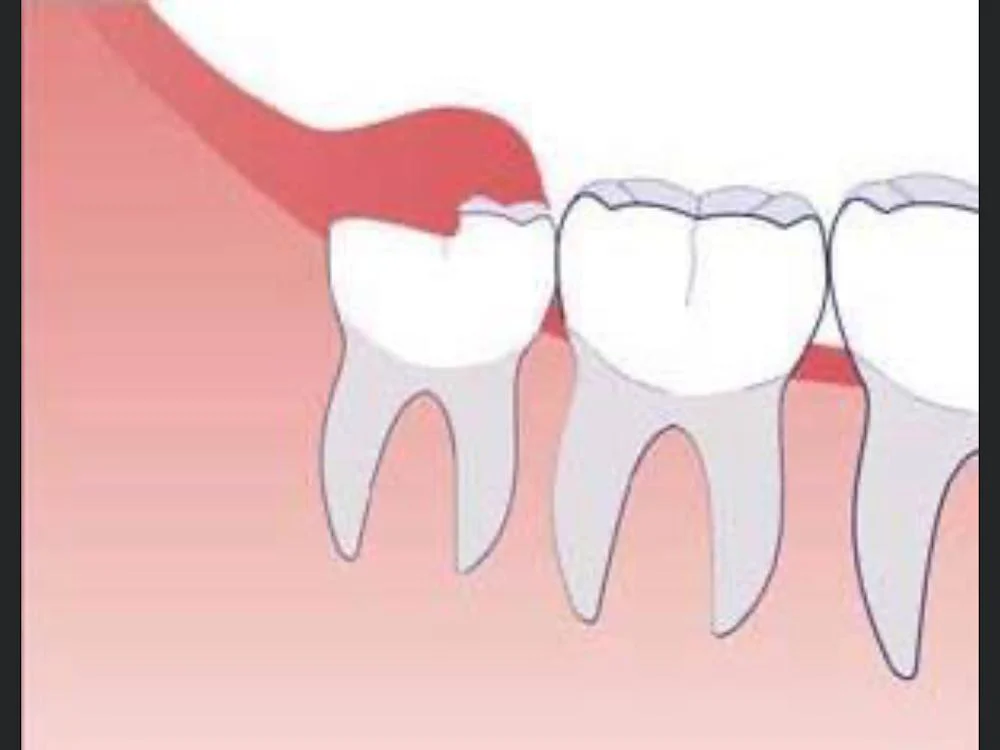 Charles H. Hoffman, DDS Oral and Maxillofacial Surgeon 6