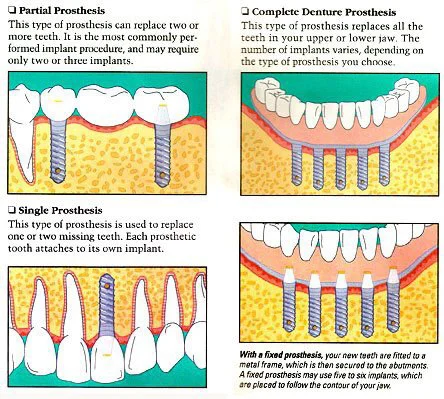 Charles H. Hoffman, DDS Oral and Maxillofacial Surgeon 8