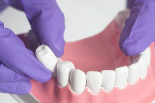 Jutkowitz Periodontics & Implantology 9