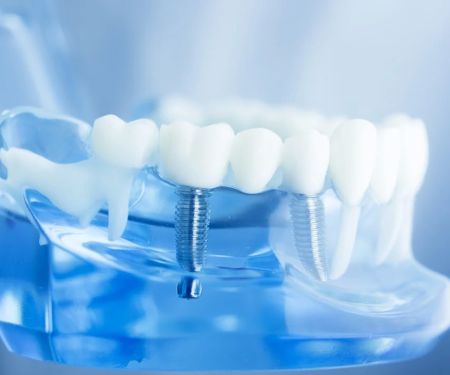 Beyond Periodontics