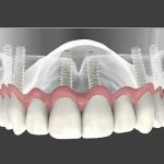 Montclair Perio & Implant Specialists: Anne Hartnett, DDS
