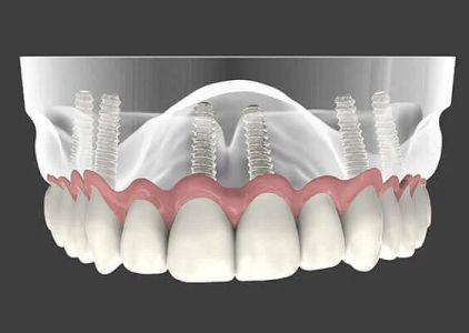 Montclair Perio & Implant Specialists: Anne Hartnett, DDS