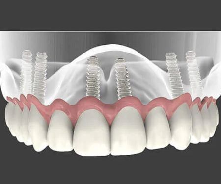Montclair Perio & Implant Specialists: Anne Hartnett, DDS
