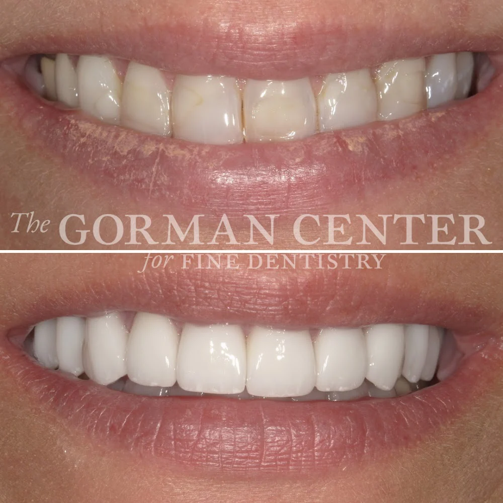 The Gorman Center for Fine Dentistry 8