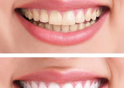Mastaj Orthodontics: Dr. LynAnn Mastaj