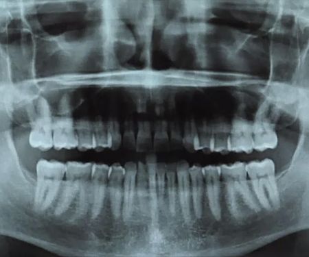 Donoho Geoffrey E DDS