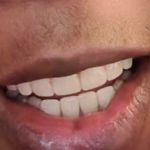 Bala Periodontics and Dental Implants