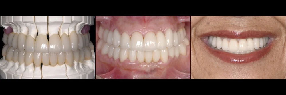 Bay Area Prosthodontics 2