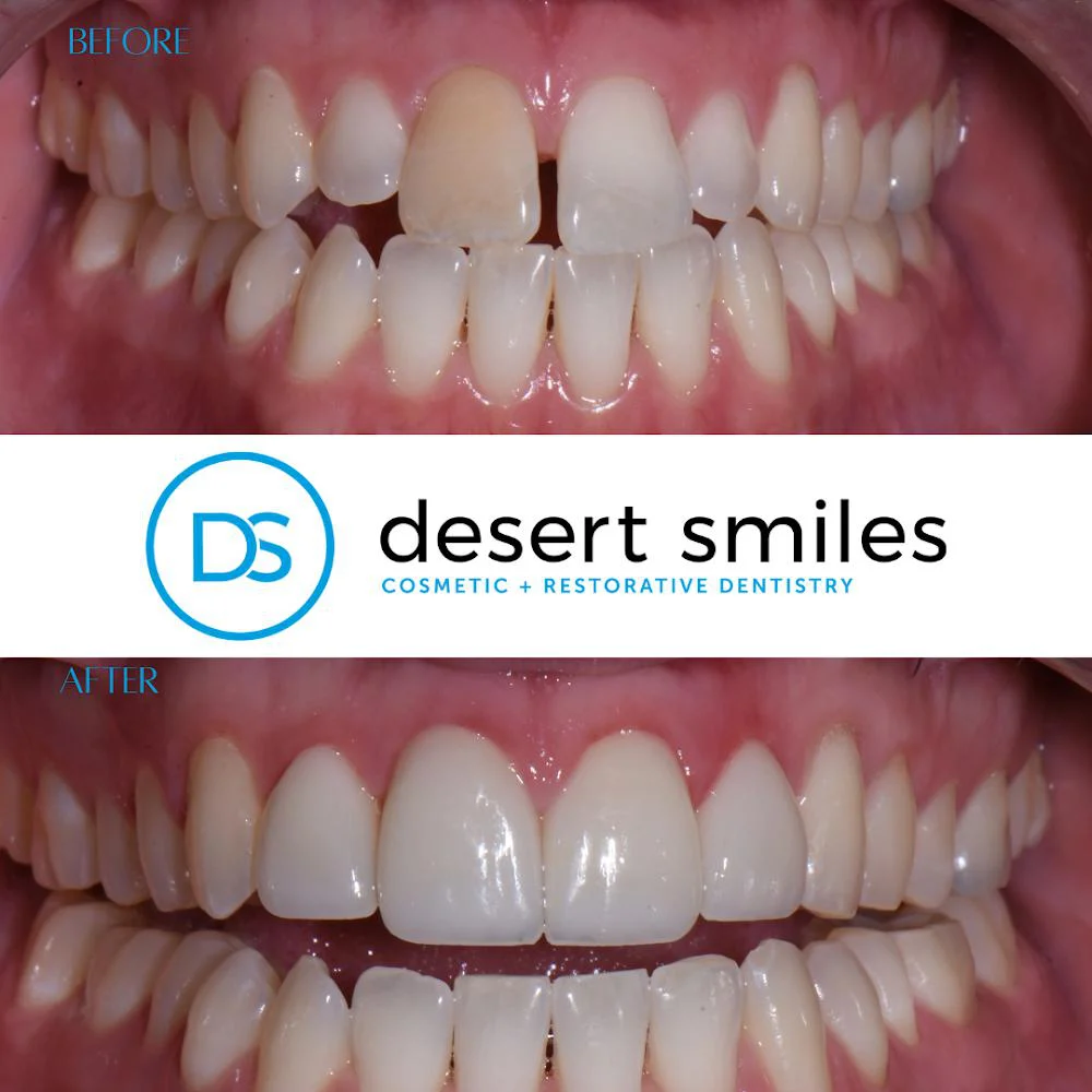 Desert Smiles Cosmetic & Restorative Dentistry 3