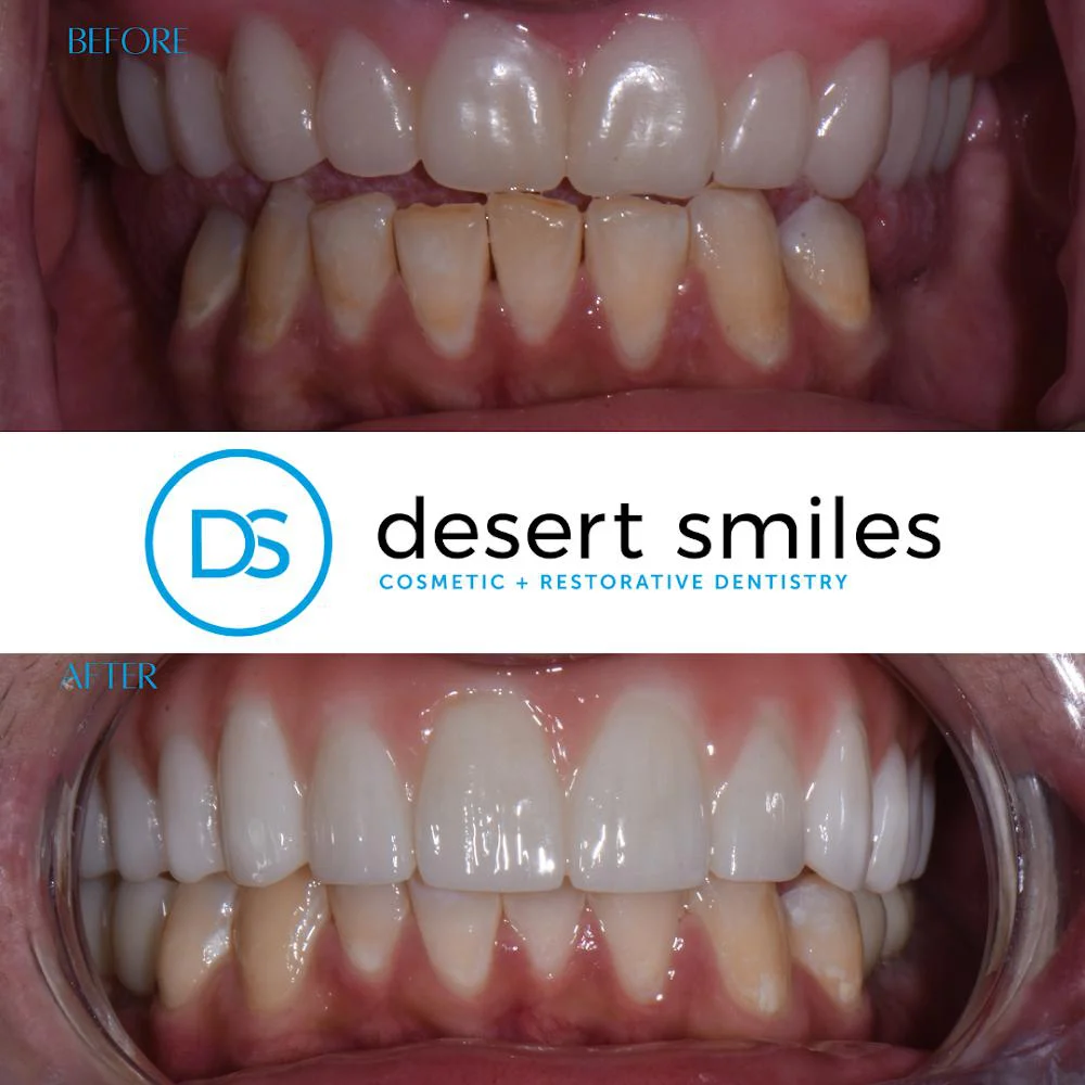 Desert Smiles Cosmetic & Restorative Dentistry 5