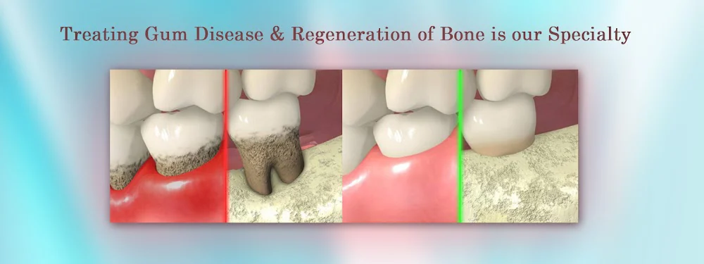 Sam B Khoury DDS MS-Dental Implant & Perio Surgeons 10