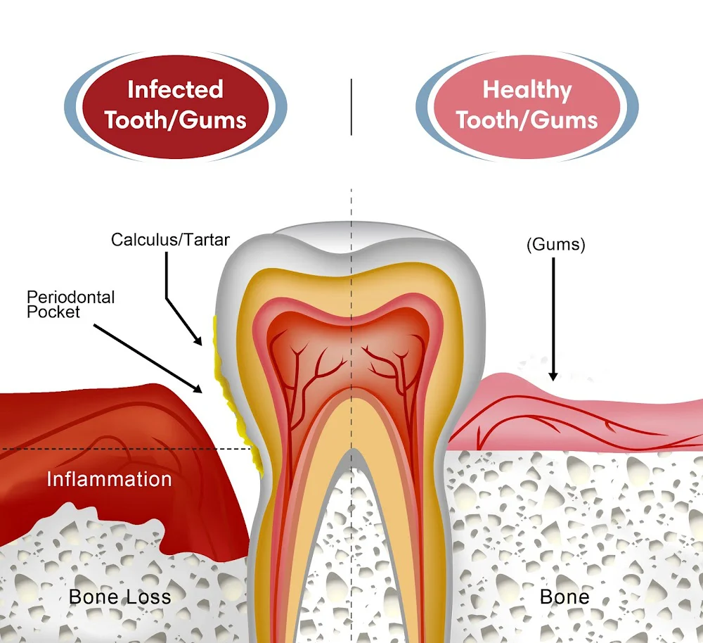 Sam B Khoury DDS MS-Dental Implant & Perio Surgeons 9