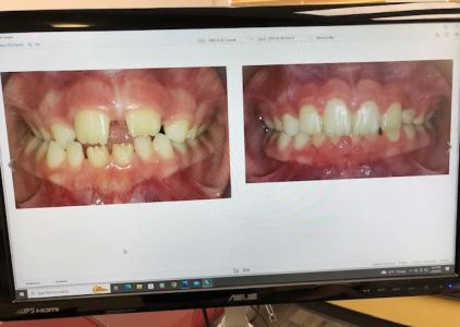 Kate Lembck Orthodontics