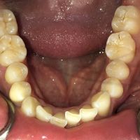 Team Dental ico