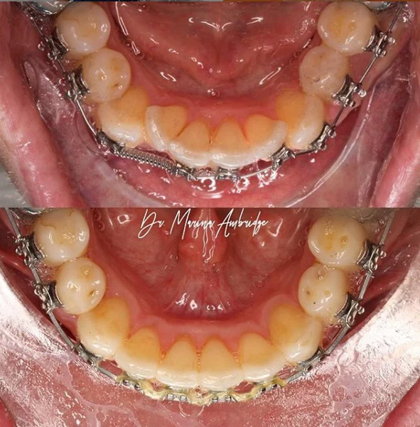 The Smile Institute Advanced Dentistry & Orthodontics 6