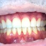 Karin Hatami DDS, SmileXthetics