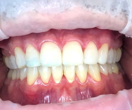 Karin Hatami DDS, SmileXthetics