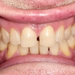 Briney Jeffrey R DDS