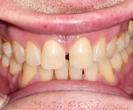 Briney Jeffrey R DDS