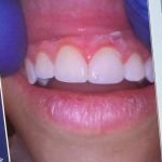 Graham Family Dental Care