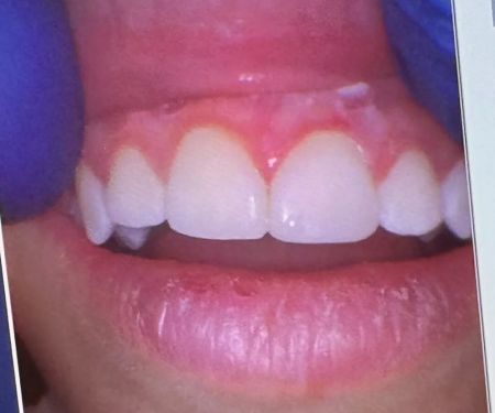 Graham Family Dental Care