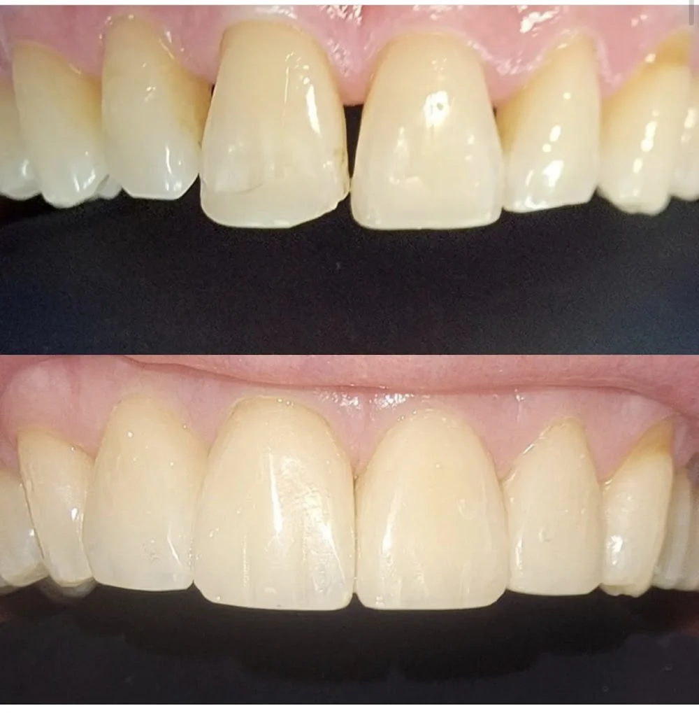 Desert Ridge Smiles - Radhika Rawal DDS 7