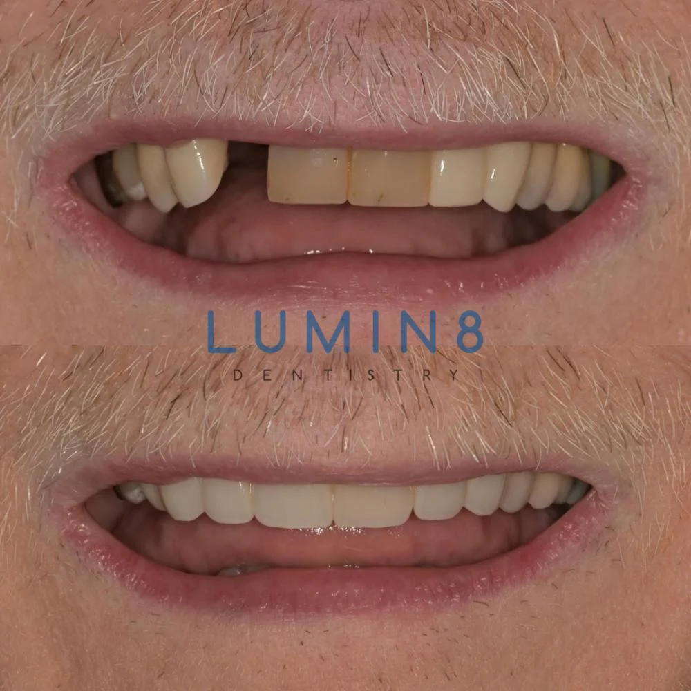 Lumin8 Dentistry 3