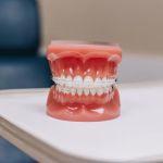 Bordentown Braces