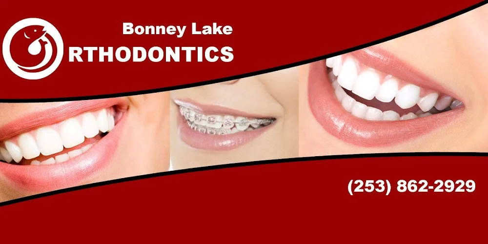 Bonney Lake Orthodontics 8