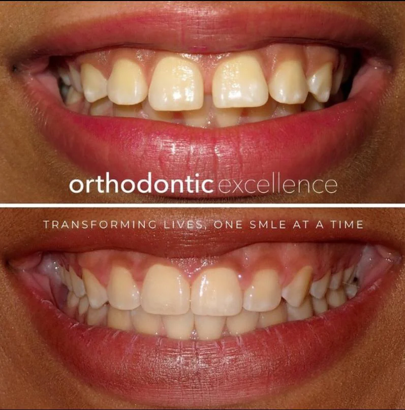 Orthodontic Excellence - Bonney Lake 4