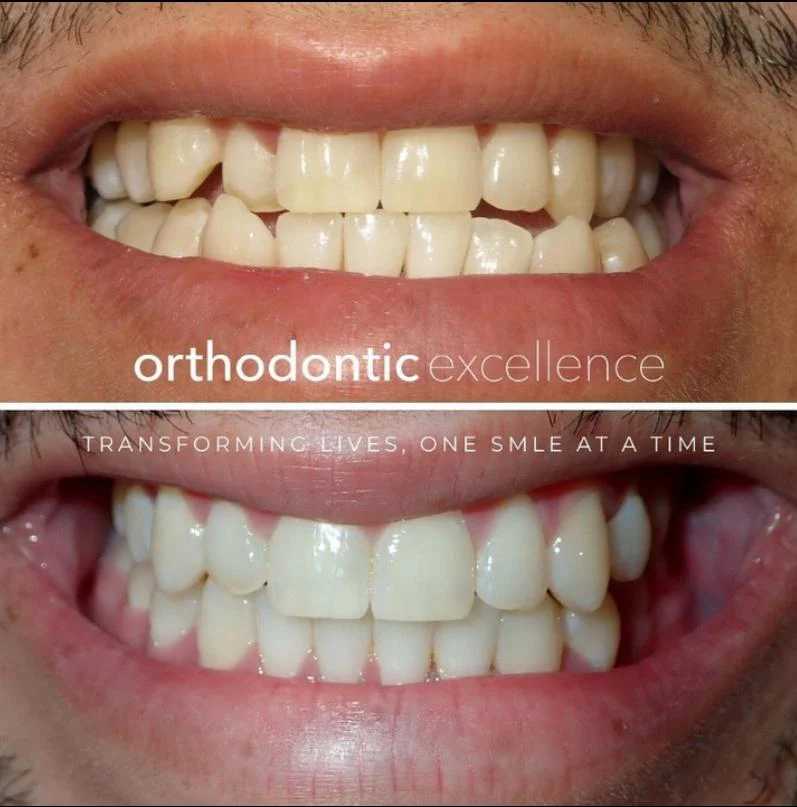 Orthodontic Excellence - Bonney Lake 2