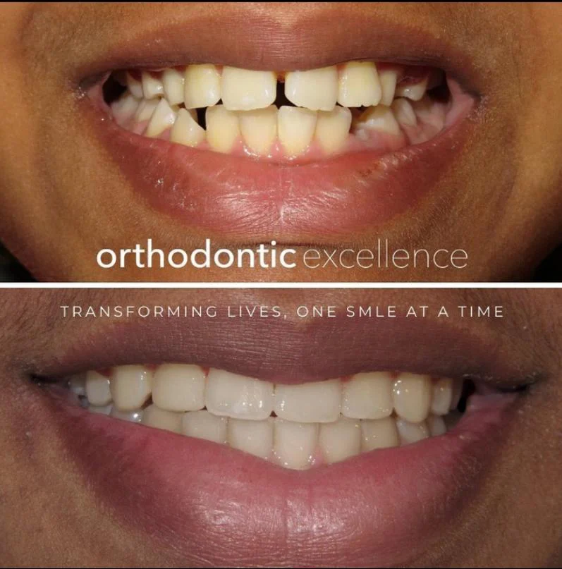 Orthodontic Excellence - Bonney Lake 6