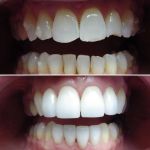 Wonderful Smiles - Puyallup Dentist
