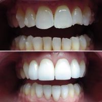 Wonderful Smiles - Puyallup Dentist ico
