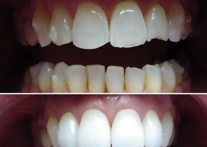 Wonderful Smiles - Puyallup Dentist