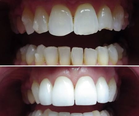 Wonderful Smiles - Puyallup Dentist