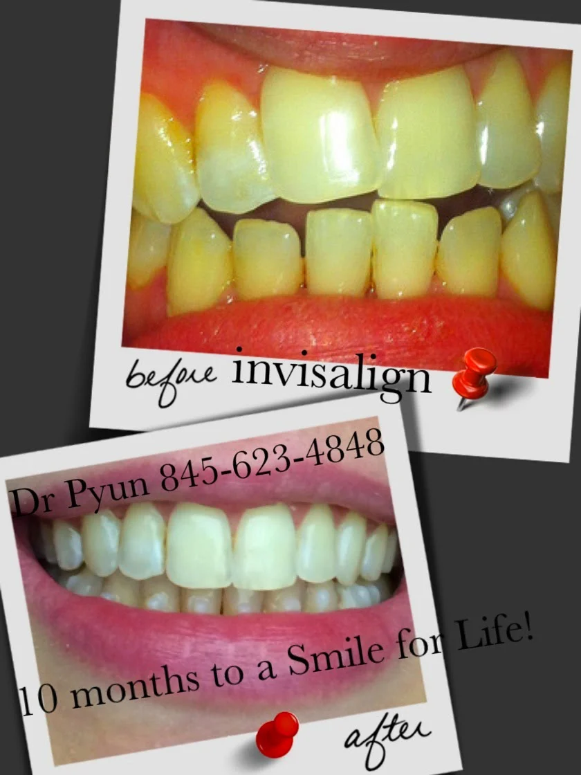 Smile for Life Family & Cosmetic Dental 8