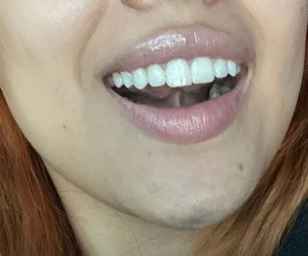 Copiague Dental