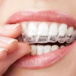 Yang Orthodontics - Invisalign & Braces in Newtown