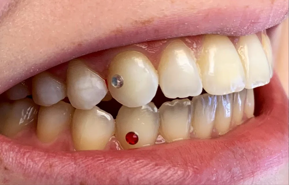 Anna Ellerin DDS Picture 1