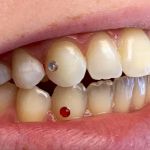 Anna Ellerin DDS