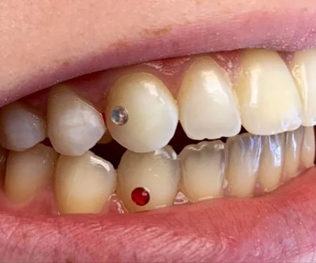 Anna Ellerin DDS