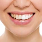 ADVANCED SMILES PC