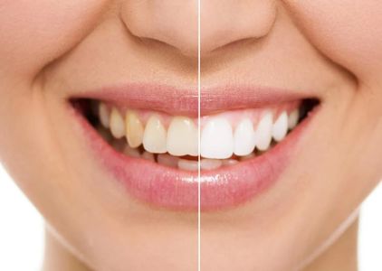 ADVANCED SMILES PC