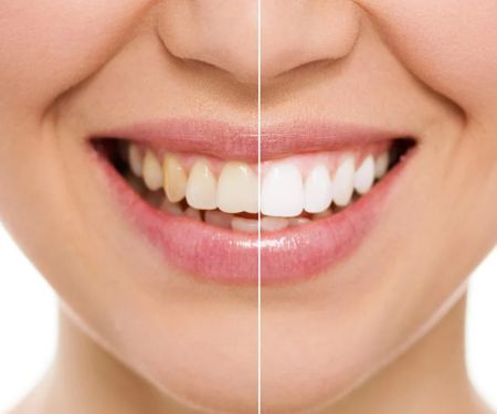 ADVANCED SMILES PC