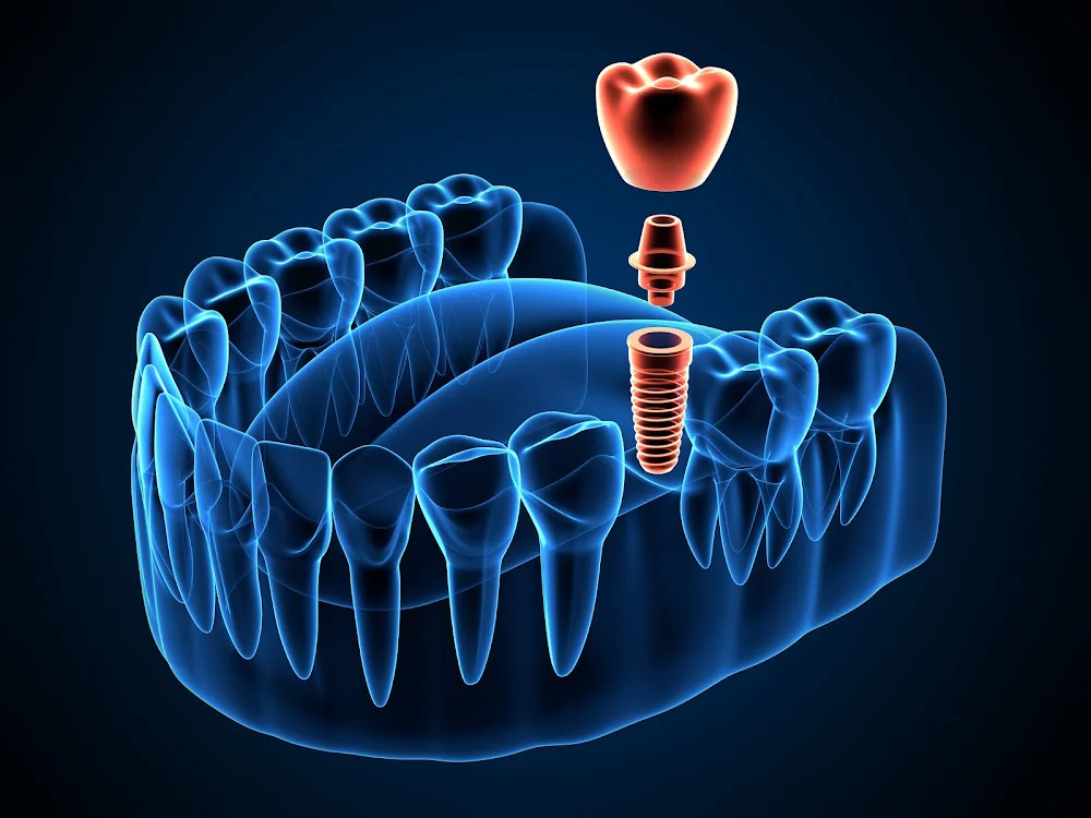 Lane Oral & Maxillofacial Surgery & Dental Implant Center 7