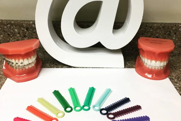 Always Orthodontics | Dr. Ava Kamenshchik 9