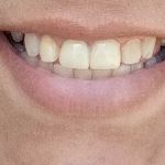 Dental Dreams