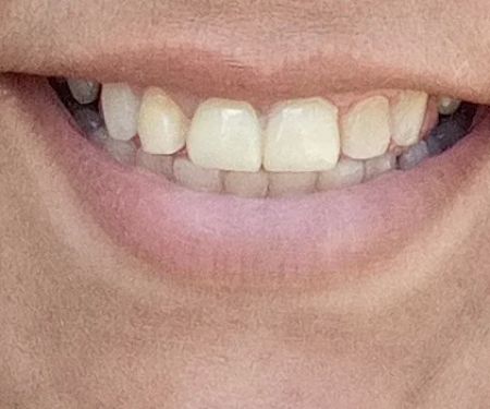 Dental Dreams