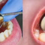 Stites Dental Care